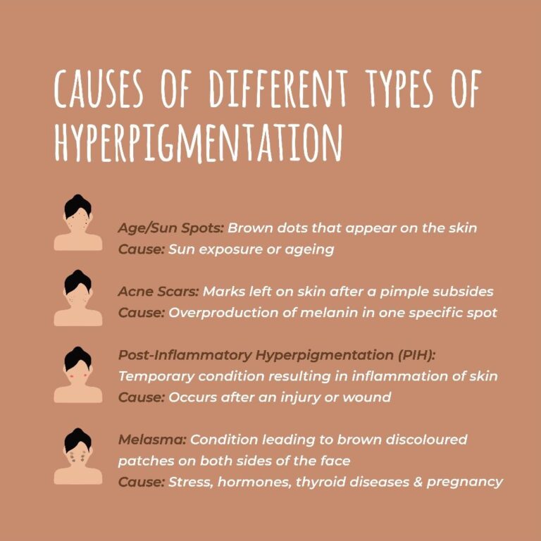 What Causes Hyperpigmentation and How to Treat It